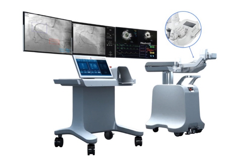 국산 1호 혈관 수술로봇 첫 스텐트 시술 성공 7578